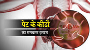 पेट के कीड़ों(stomach worms) को करें जड़ से खत्म
